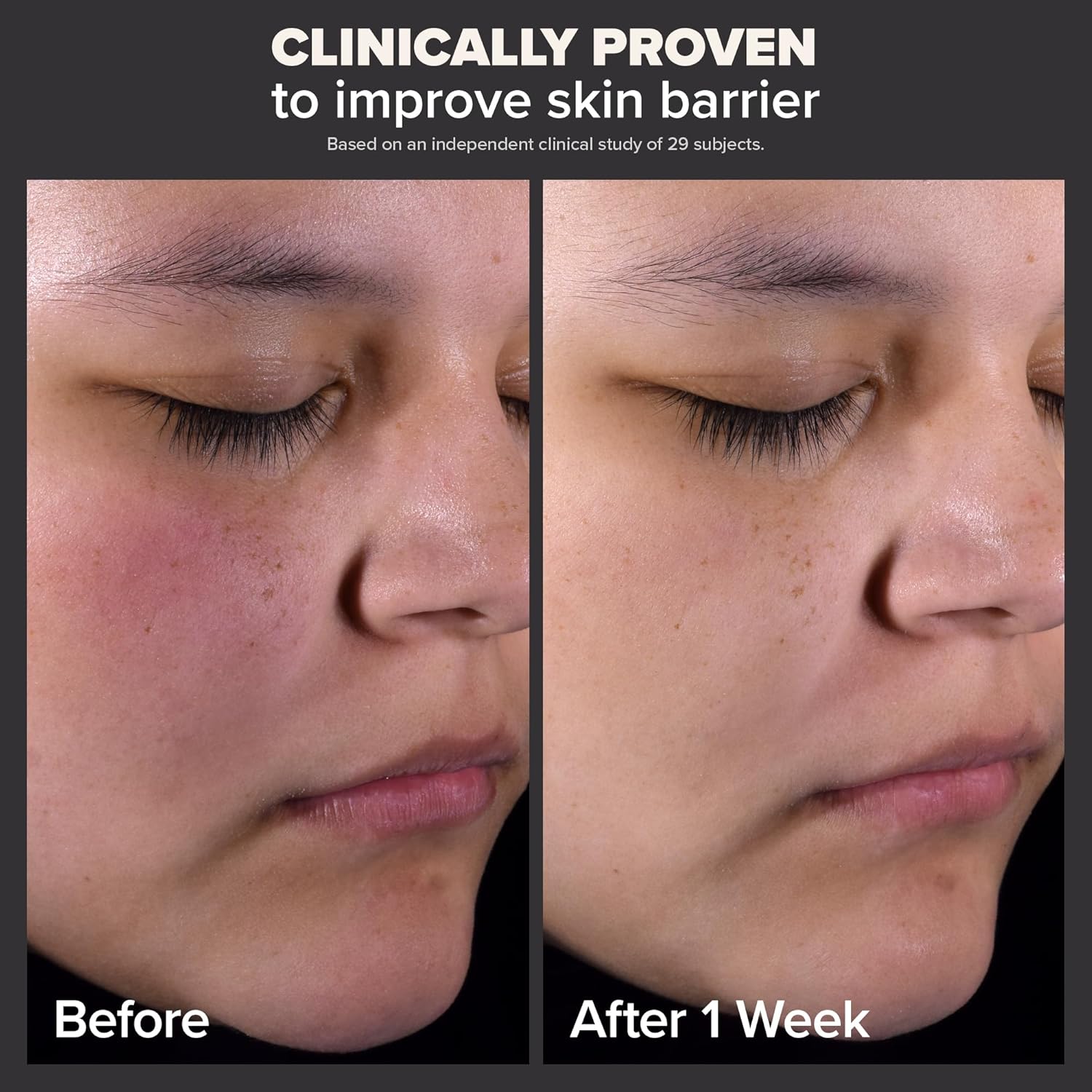  "Paula's Choice SKIN PERFECTING 2% BHA Liquid Exfoliant, 30ml bottle for blackhead and pore care."